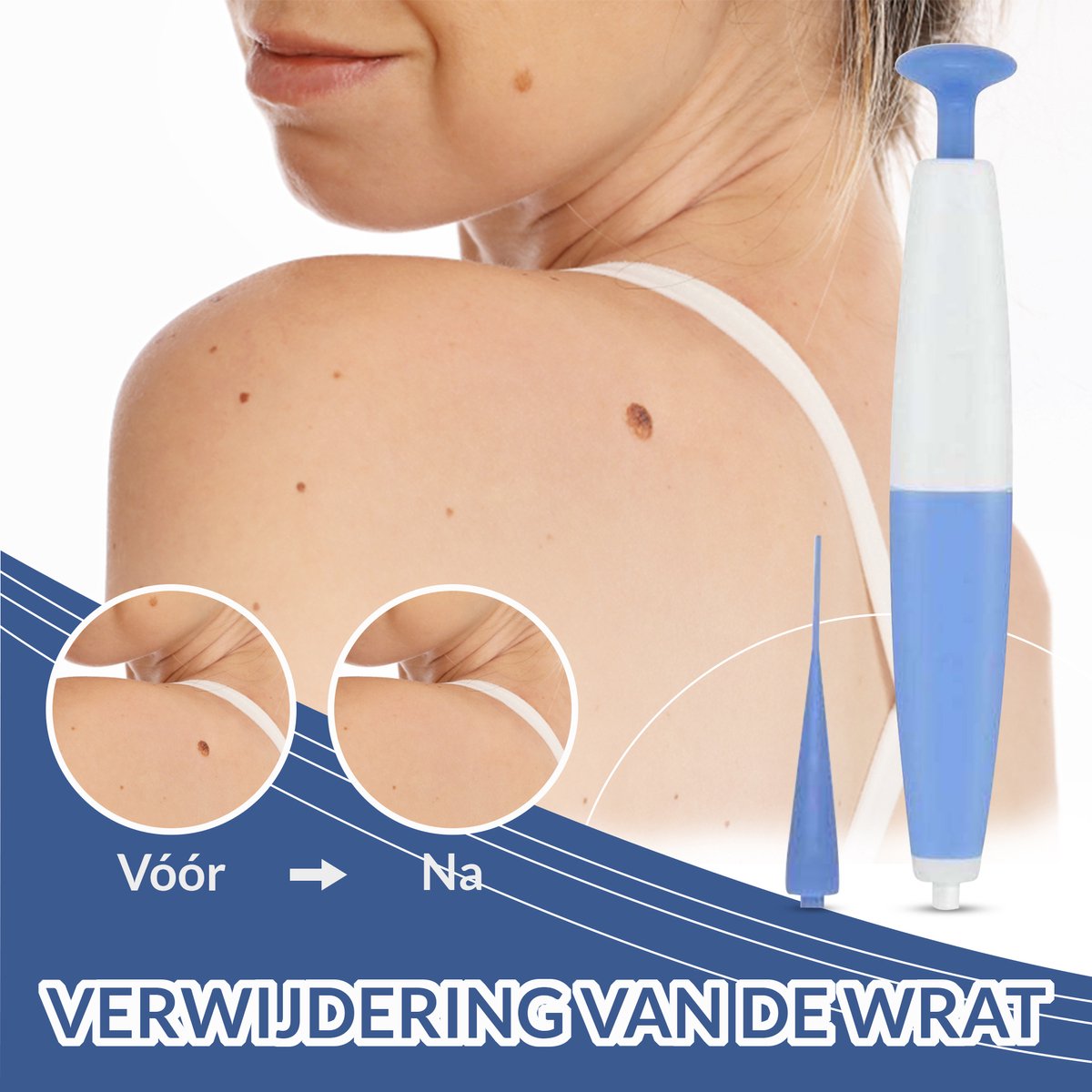 SilkTag™ I Wratvrij in slechts 2 weken!