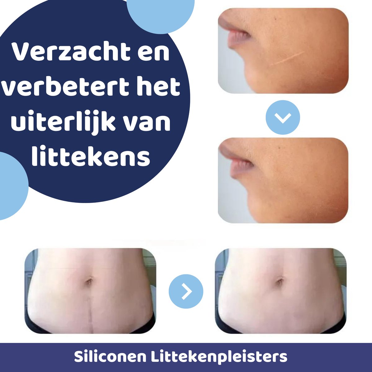 DermaSilk™ | Herstel je huid op een natuurlijke manier