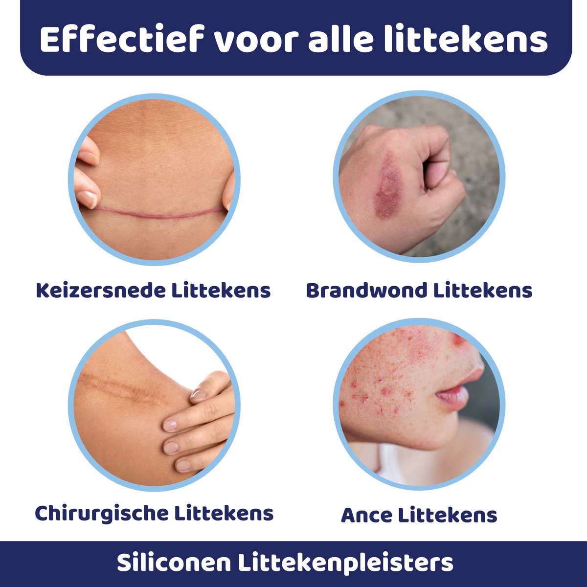 DermaSilk™ | Herstel je huid op een natuurlijke manier