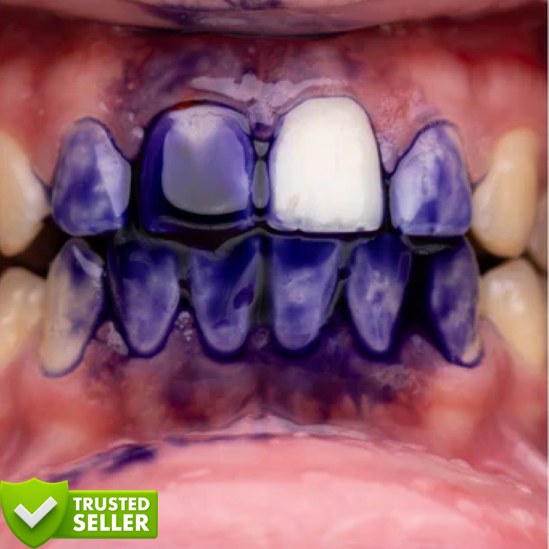 Purple V34™ | Witte tanden in slechts 5 minuten!