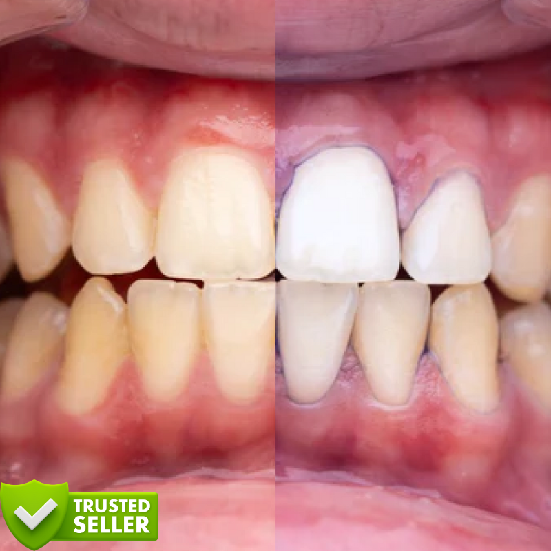 Purple V34™ | Witte tanden in slechts 5 minuten!