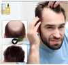 GrowLuxe™ I Haarolie voor gezond en sterk haar!