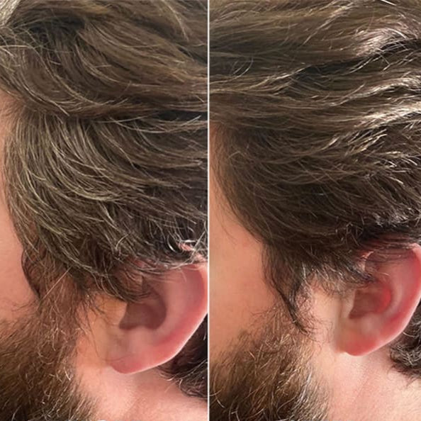 NovaHair™ | Snel van je grijze haren af!