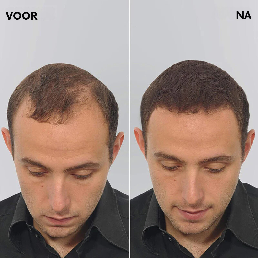 VelourHair™ | Geen kale plekken meer!