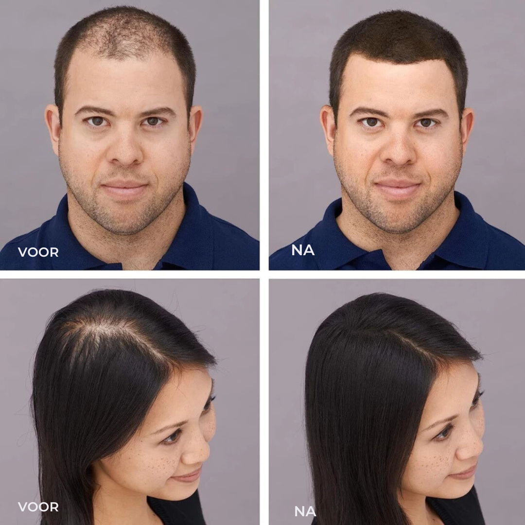 VelourHair™ | Geen kale plekken meer!
