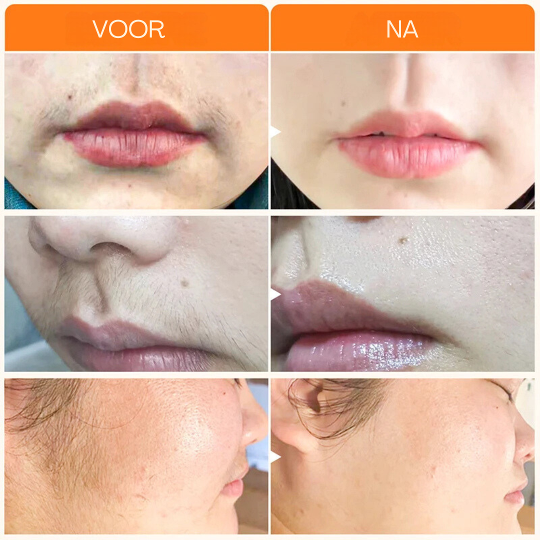 SmoothGlow™ | Verwijder snel ongewenste haren