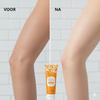 PureTone™ | Zeg vaarwel tegen donkere plekken en een doffe huid