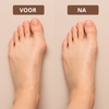 BunionRelief™ | Corrigeer pijnlijke knobbels