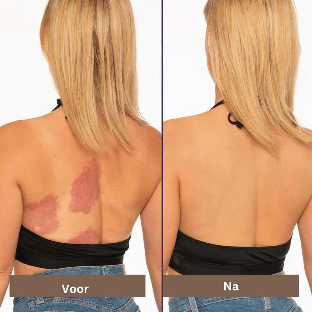 CoverSkin™ | Altijd een egale en vlekkeloze huid!