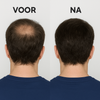 VoltHair™ | Voller haar met één behandeling!