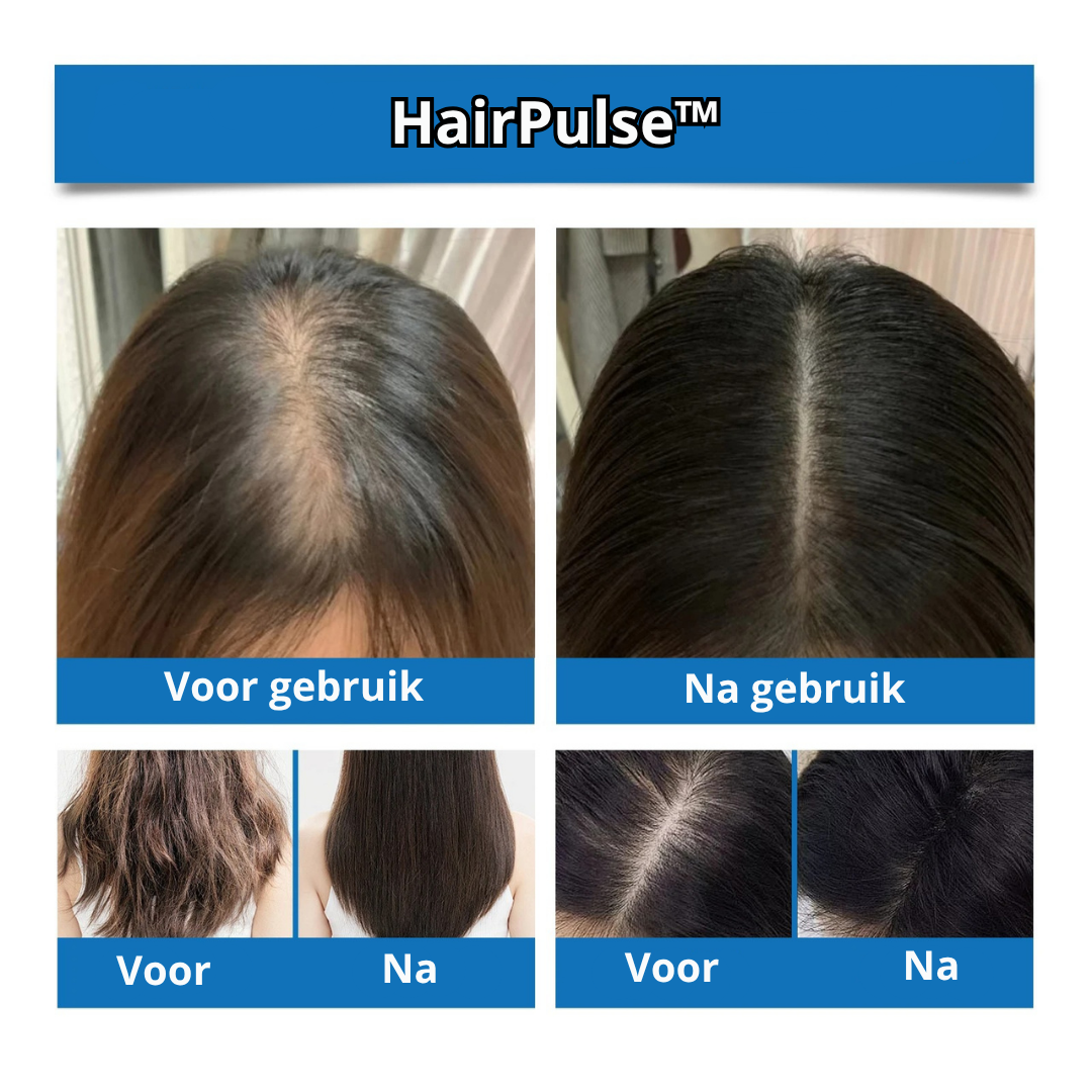 HairPulse™ | Voor zichtbare haargroei in weken