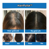 HairPulse™ | Voor zichtbare haargroei in weken