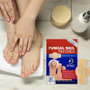 NailRenew™ | Pakt schimmelnagels effectief aan!