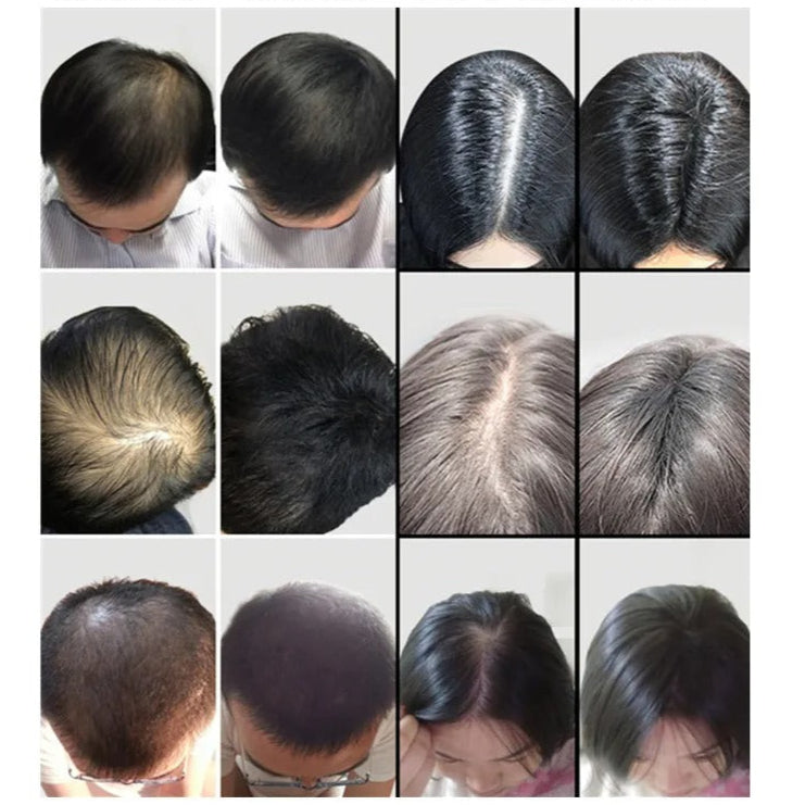 VelourHair™ | Geen kale plekken meer!