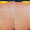 SmoothEase™ | Zachte ontharing zonder pijn of irritatie